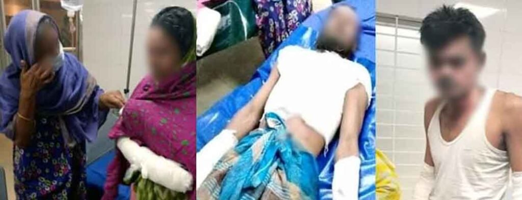 নারায়ণগঞ্জে গ্যাস লিকেজ থেকে বিস্ফোরণ হয়ে দগ্ধ ৪ আহত ৬