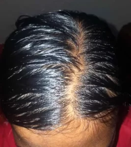 প্রাকৃতিক উপায়ে পাতলা চুল ঘন করার উপায়