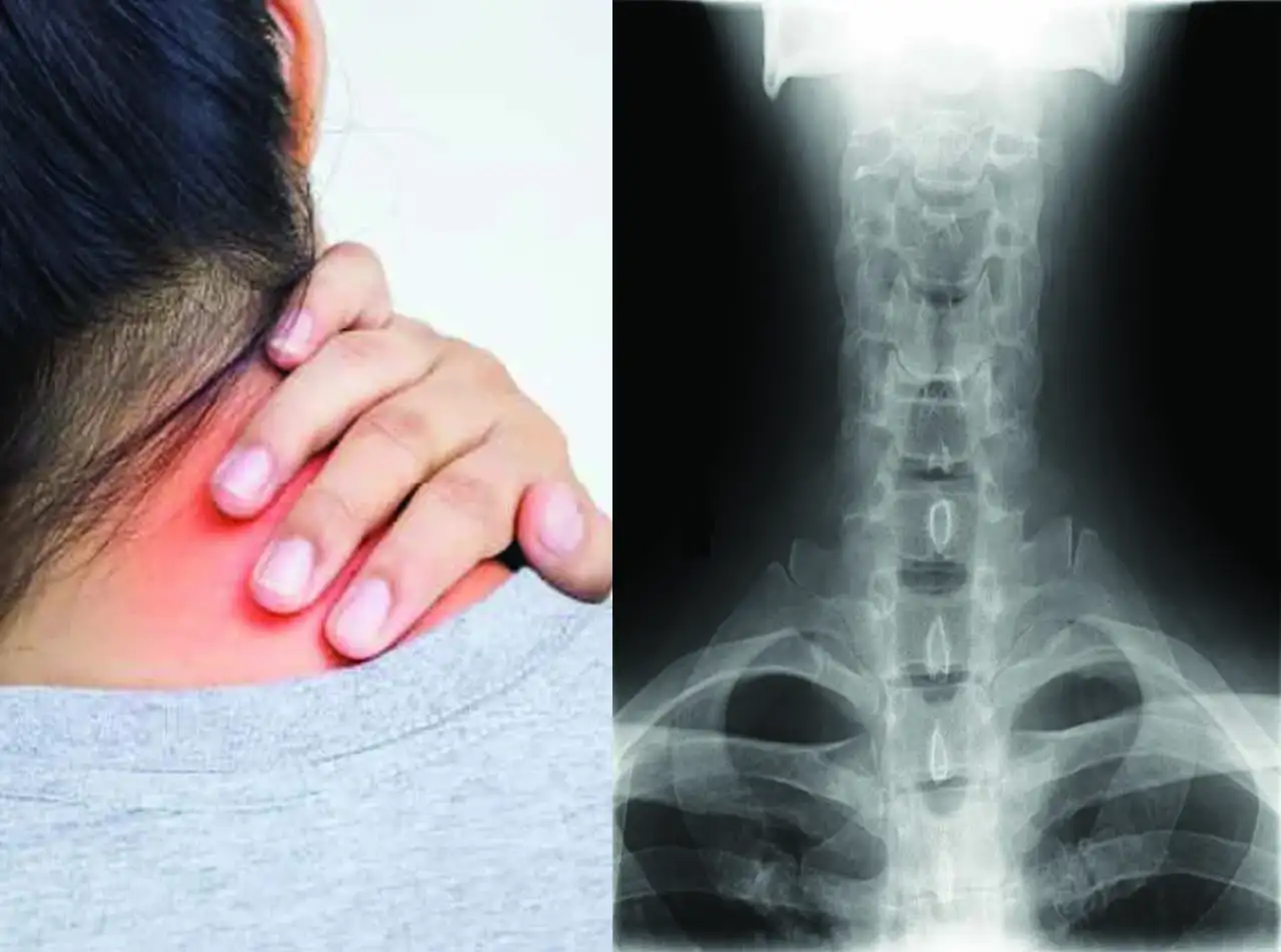 ঘাড়ের ব্যথা হওয়ার কারণ, লক্ষণ ও প্রতিকার