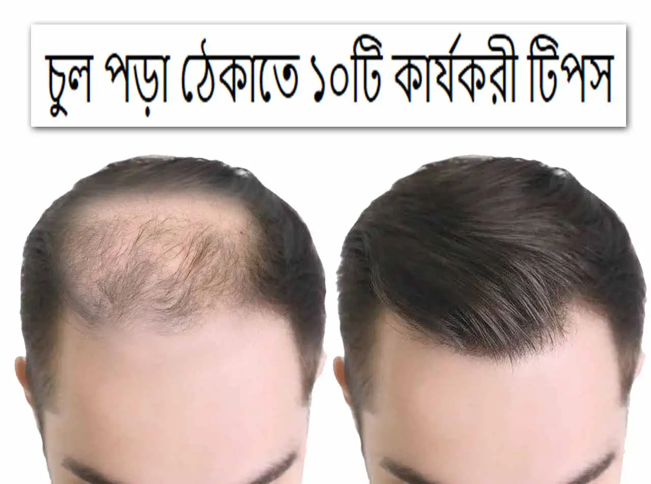চুল পড়া ঠেকাতে ১০টি কার্যকরী টিপস