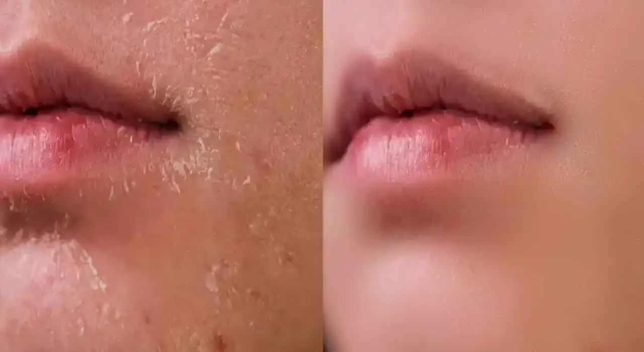 শীতে চেহারার উজ্জ্বলতা বৃদ্ধির সহজ উপায়