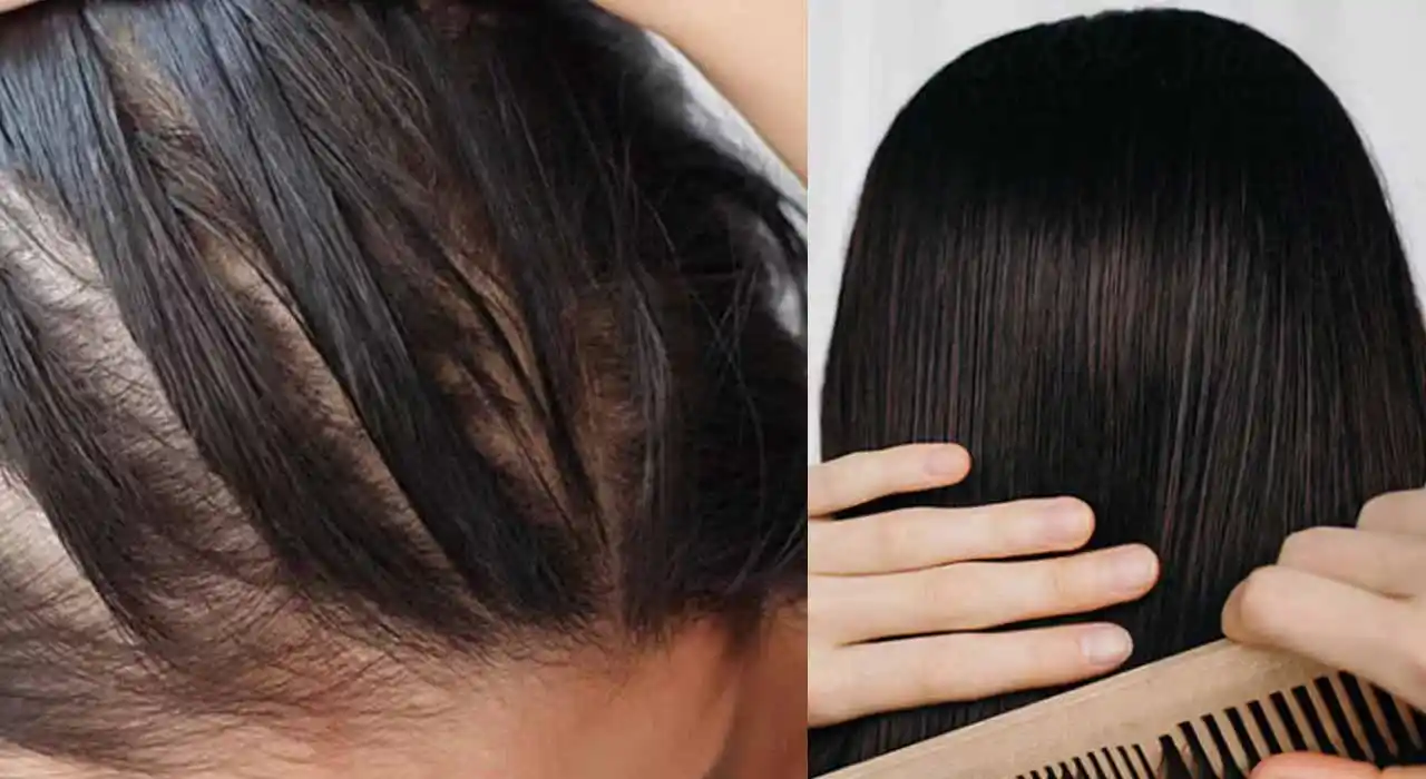 দ্রুত চুল ঘন করার উপায় সম্পর্কে জানুন