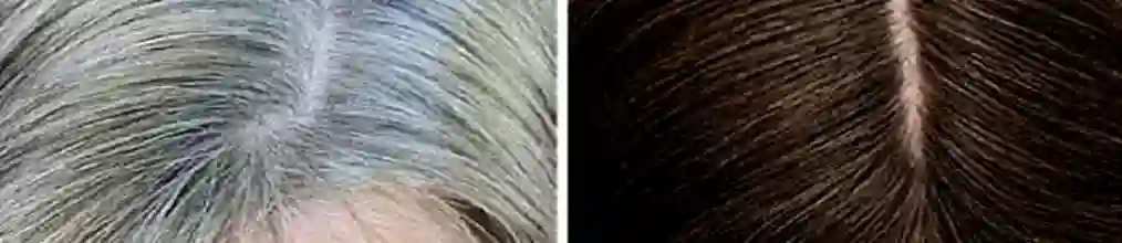 পাকা চুল কালো করার ঘরোয়া উপায়